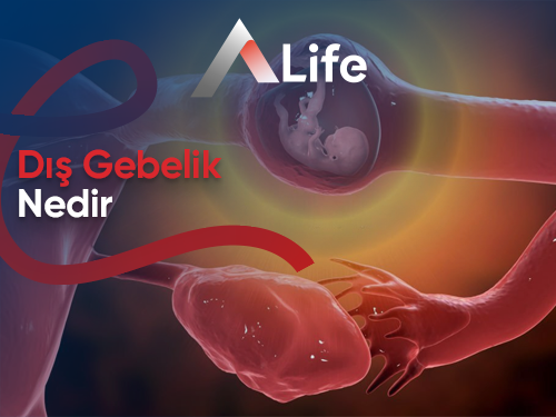 Dış Gebelik Nedir ?